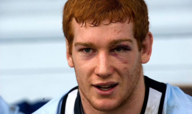 Scotland's Rob Harley sports a black eye during training