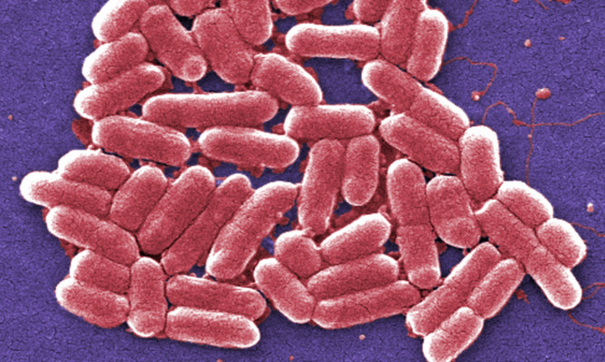 2006
National Escherichia, Shigella, Vibrio Reference Unit at CDC

Under a magnification of 6836x, this colorized scanning electron micrograph (SEM) depicted a number of Gram-negative Escherichia coli bacteria of the strain O157:H7, which is one of hundreds of strains of this bacterium. Although most strains are harmless, and live in the intestines of healthy humans and animals, this strain produces a powerful toxin, which can cause severe illness.E. coli O157:H7 was first recognized as a cause of illness in 1982 during an outbreak of severe bloody diarrhea; the outbreak was traced to contaminated hamburgers. Since then, most infections have come from eating undercooked ground beef.The combination of letters and numbers in the name of the bacterium refers to the specific markers found on its surface, which distinguishes it from other types of E. coli. See PHIL 8800 for a black and white version of this image.

Escherichia coli O157:H7 is an emerging cause of foodborne illness. An estimated 73,000 cases of infection, and 61 deaths occur in the United States each year. Infection often leads to bloody diarrhea, and occasionally to kidney failure. Most illness has been associated with eating undercooked, contaminated ground beef. Person-to-person contact in families and child care centers is also an important mode of transmission. Infection can also occur after drinking raw milk, and after swimming in, or drinking sewage-contaminated water.Consumers can prevent E. coli O157:H7 infection by thoroughly cooking ground beef, avoiding unpasteurized milk, and washing hands carefully. Because the organism lives in the intestines of healthy cattle, preventive measures on cattle farms and during meat processing are being investigated.