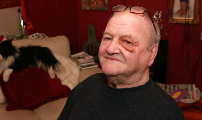 Wheelchair-bound Jack Wemyss was attacked with a shopping basket in the Tesco supermarket on Strathmartine Road.