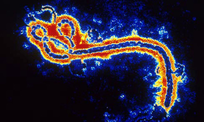 Color enhanced electron micrograph of Ebola Zaire virus. This is the first photo ever taken of the virus, on 10/13/1976 by Dr. F.A. Murphy, then at CDC. Diagnostic specimen in cell culture at 160,000 x magnification.