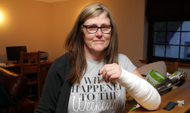 Tracy McAllister suffered injuries to her arm after being bitten by a dog.