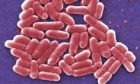 E.coli 0157 bacteria under magnification