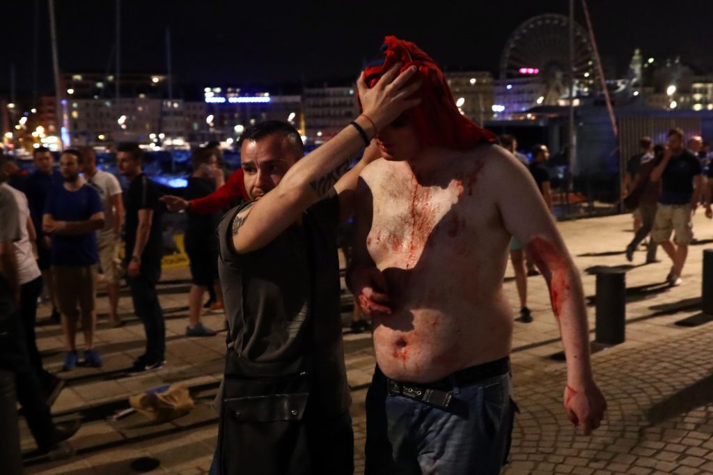 MARSEILLE, FRANCE - JUNE 10: A football fan is helped away with a head wound after England fans clashed with police in Marseille on June 10, 2016 in Marseille, France. Football fans from around Europe have descended on France for the UEFA Euro 2016 football tournament. (Photo by Carl Court/Getty Images)