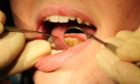 Figures show 91% of the population are signed up to a dentist.