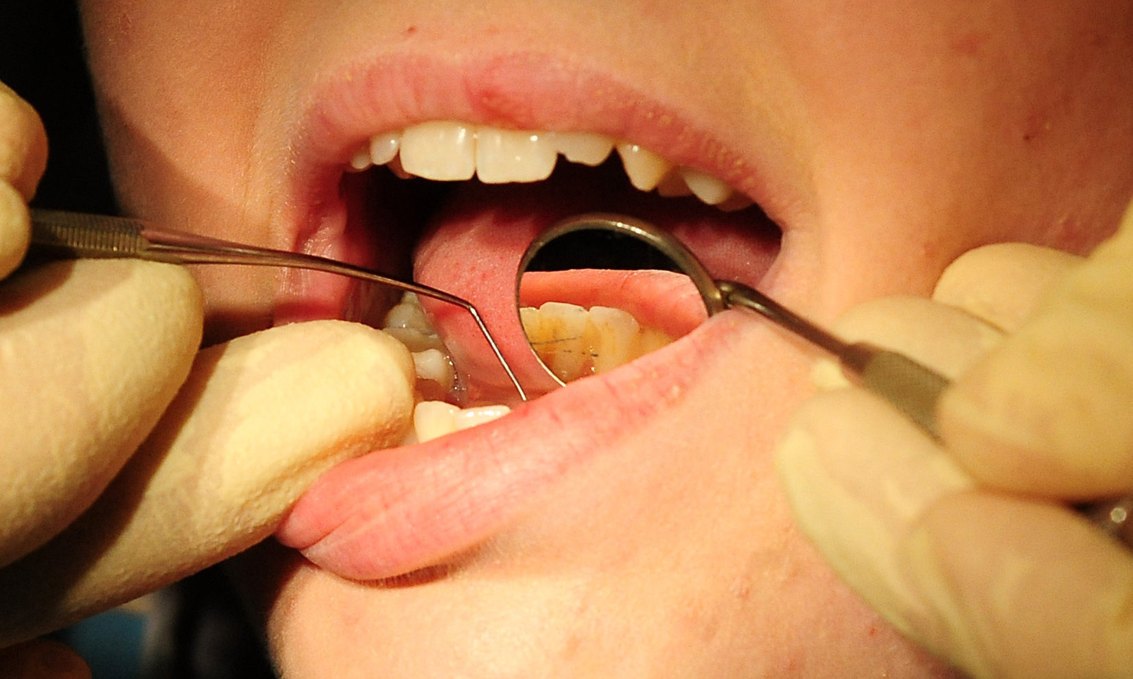 Dundee dentists diversified in response to Covid-19 - Vimarsana News