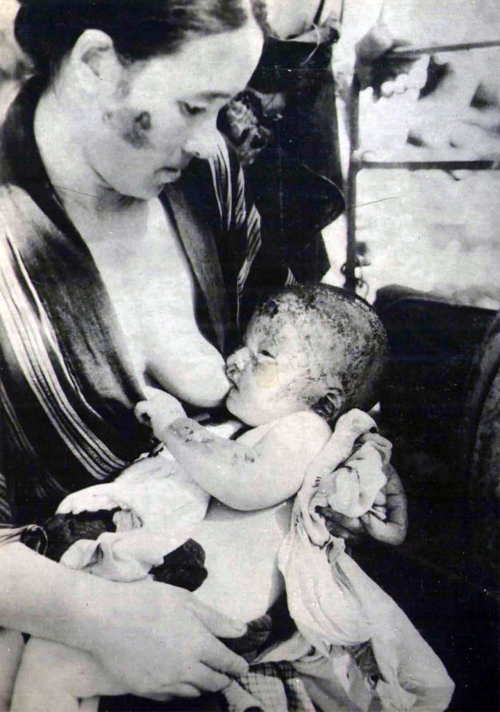 Victims of the American nuclear strike against Hiroshima in August 1945