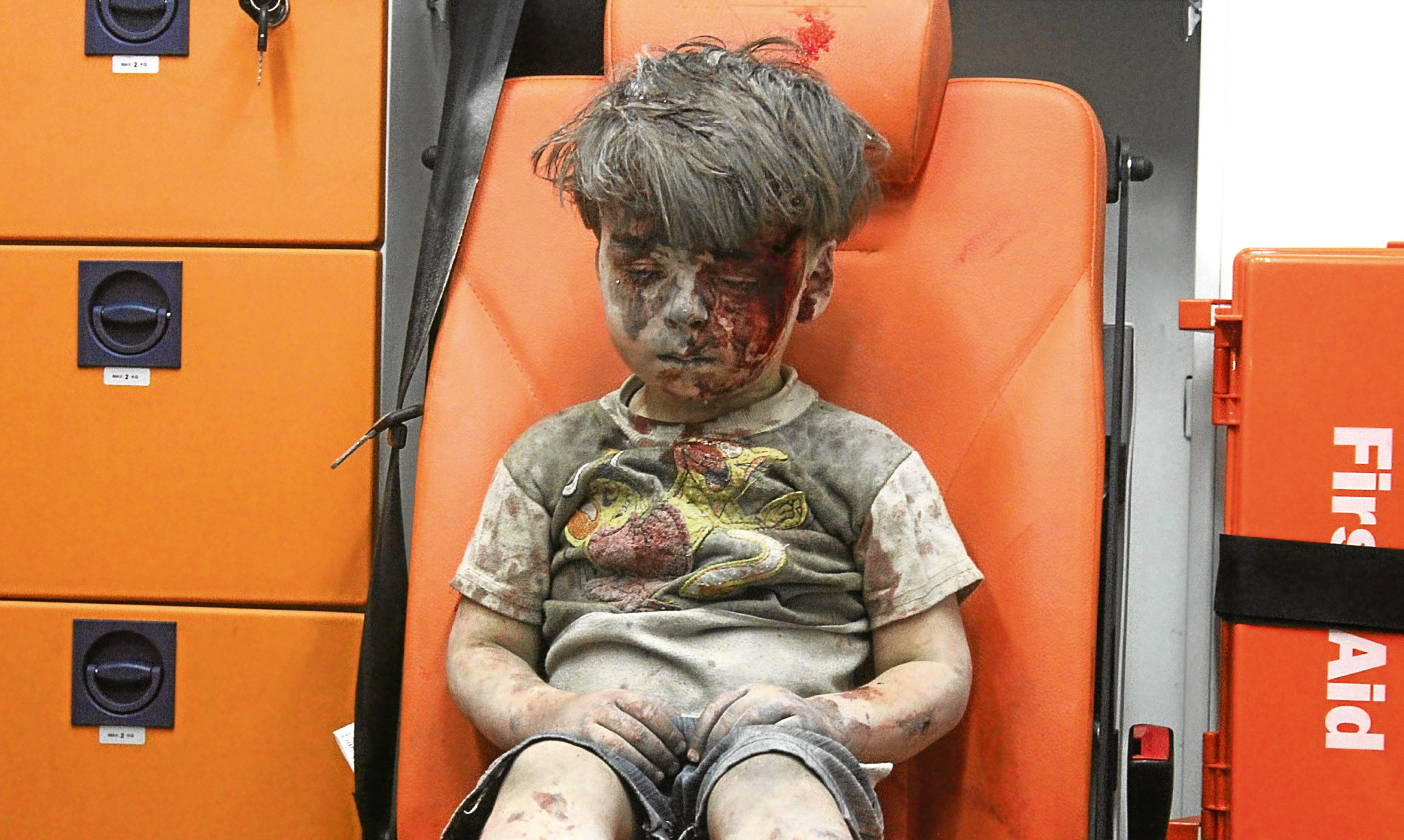 Omran Daqneesh in the back of an ambulance in Syria.