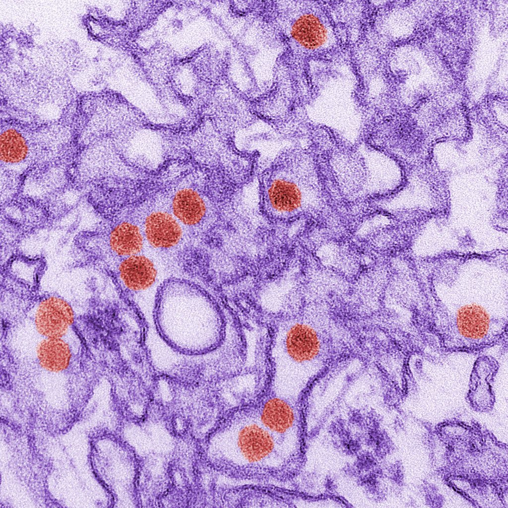 A Centers for Disease Control and Prevention (CDC) handout file image showing a transmission electron micrograph (TEM) of the Zika virus.