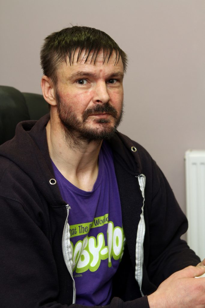 Service user John Ohren who had his leg amputated after a bad reaction to heroin in May