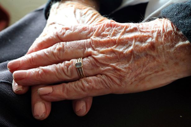 An ageing population has made dementia more common.