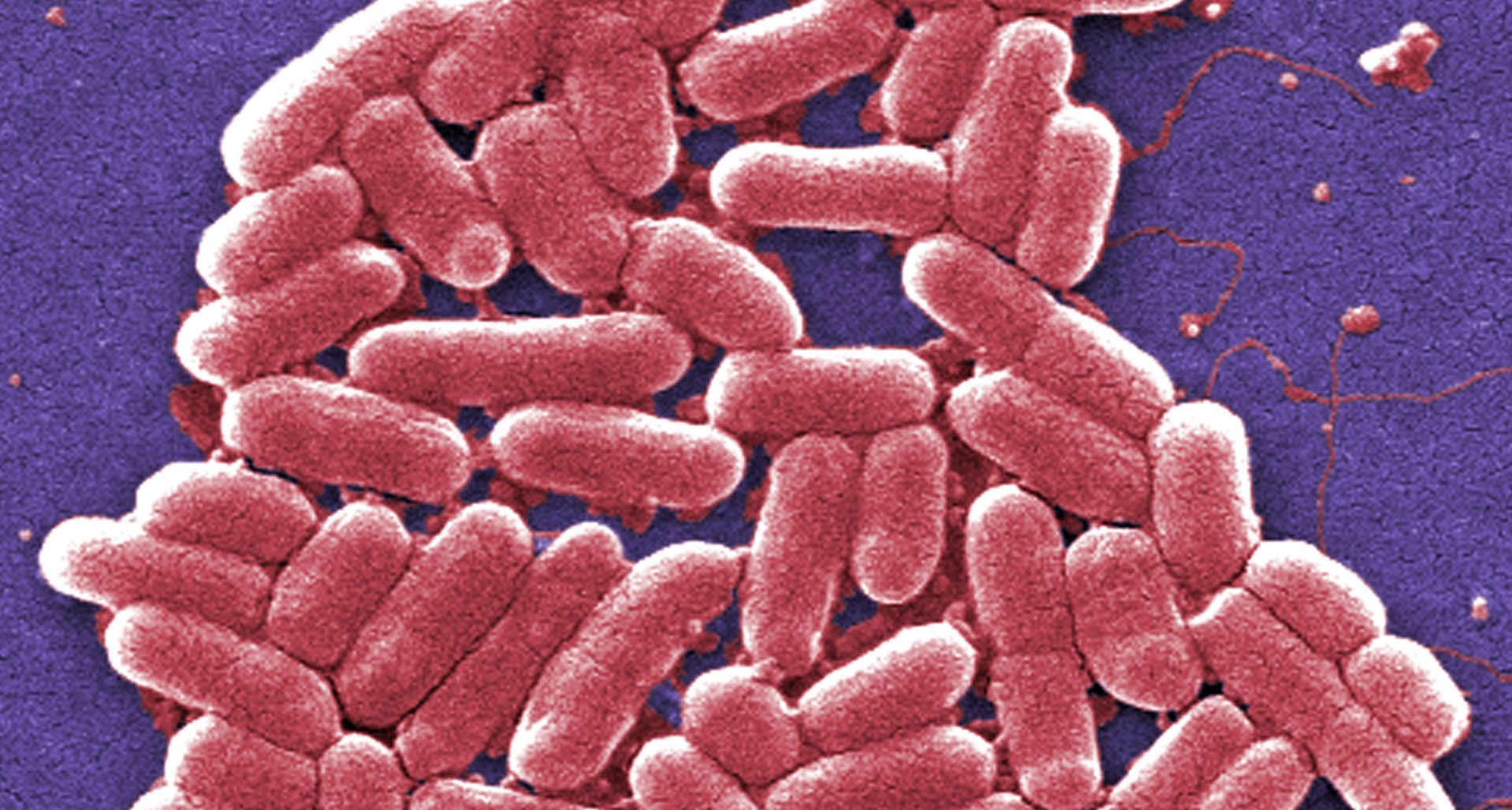 A magnified image of E. coli 0157 bacteria.