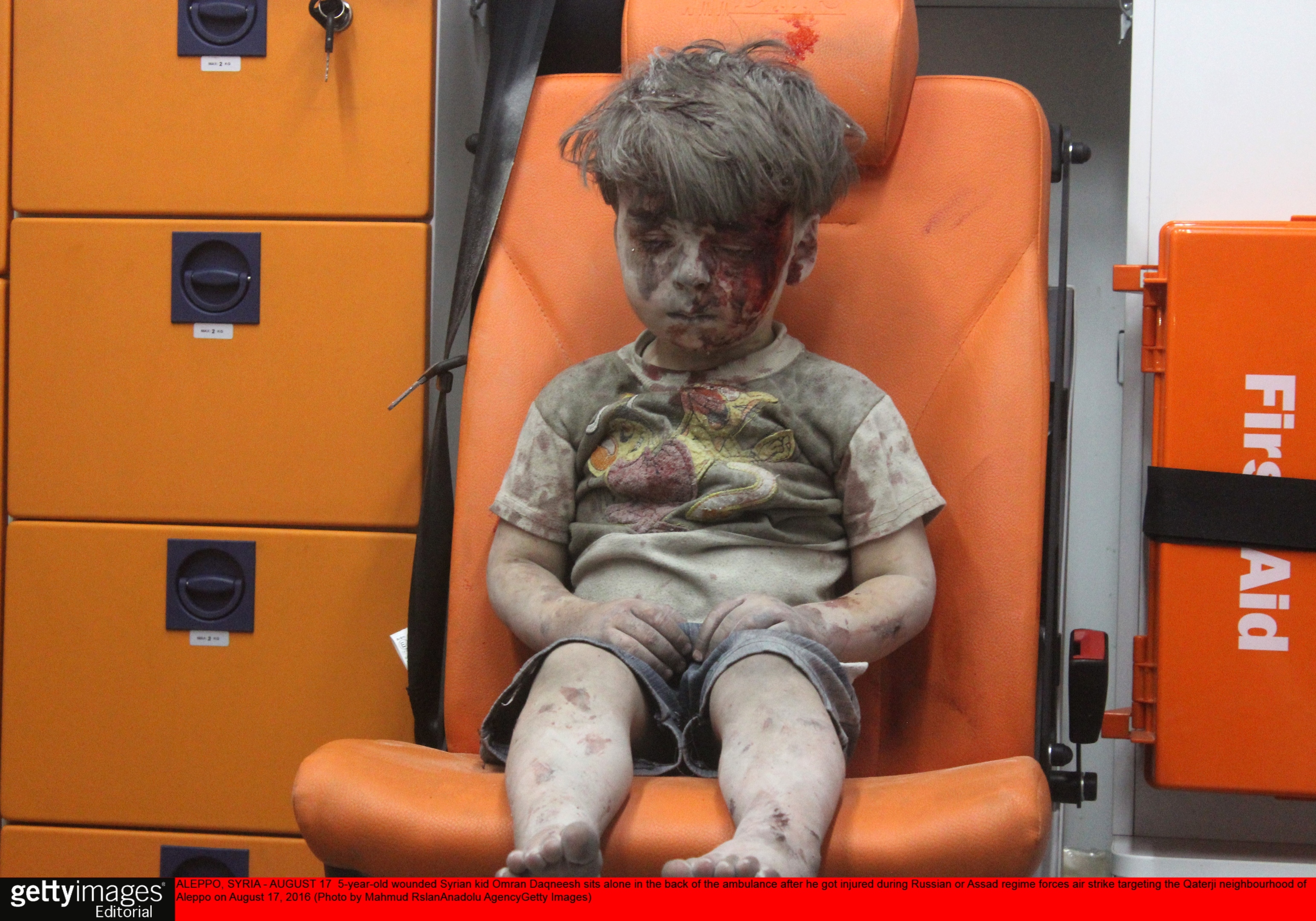 Omran Daqneesh, 5, after an air strike in Syria.