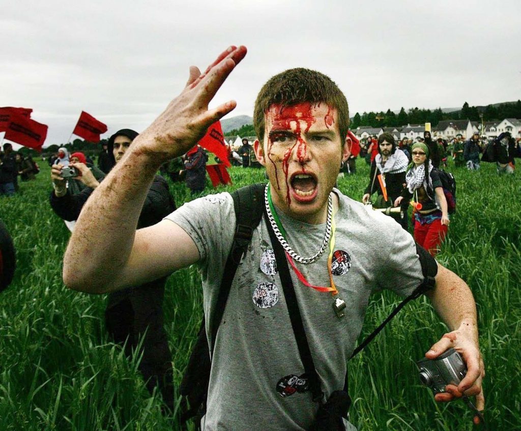 Blood on the face of a man after protestors clashed with police, at the security fence at Auchterarder surrounding the G8 summit at Gleneagles, July 6 2005. 