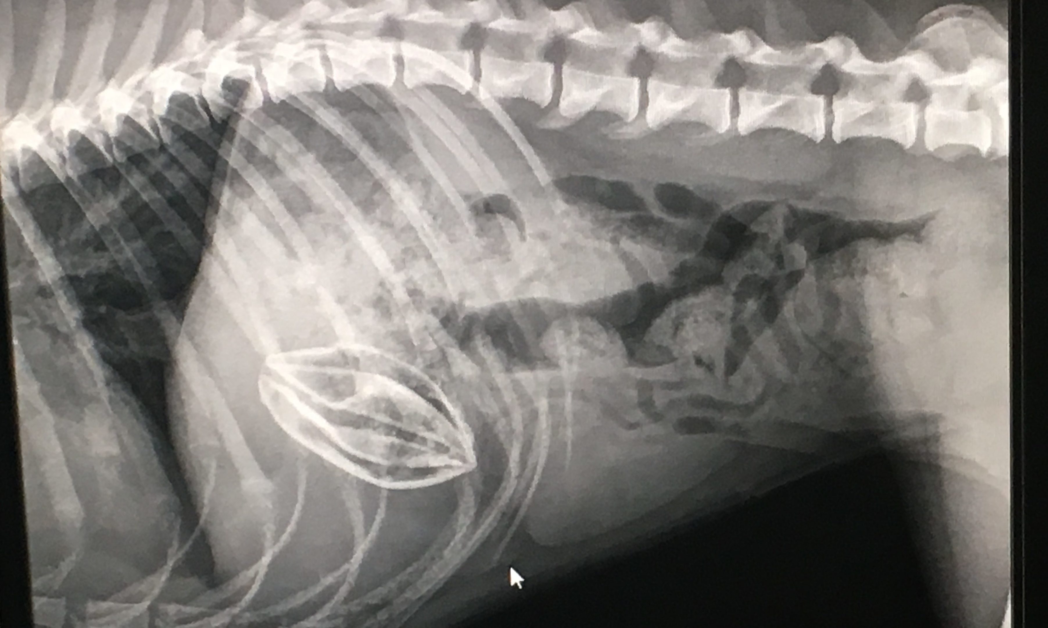 The ball showed up on the x-ray