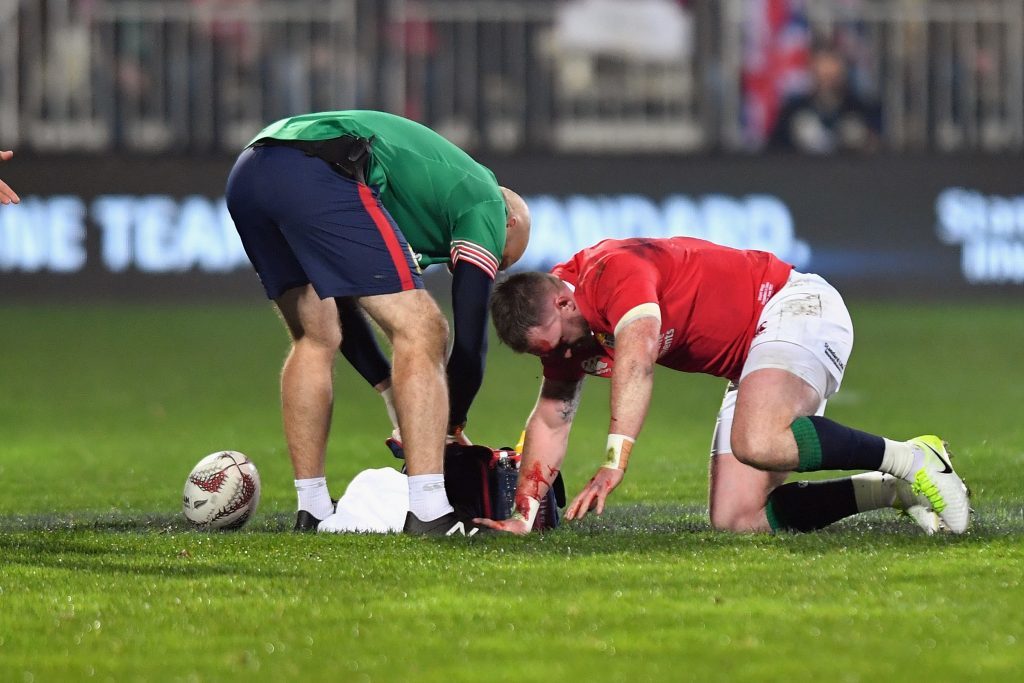 CHRISTCHURCH, NEW ZEALAND - JUNE 10: Stuart Hogg of the Lions receives medical help during the match between the Crusaders and the British & Irish Lions at AMI Stadium on June 10, 2017 in Christchurch, New Zealand. (Photo by Kai Schwoerer/Getty Images)