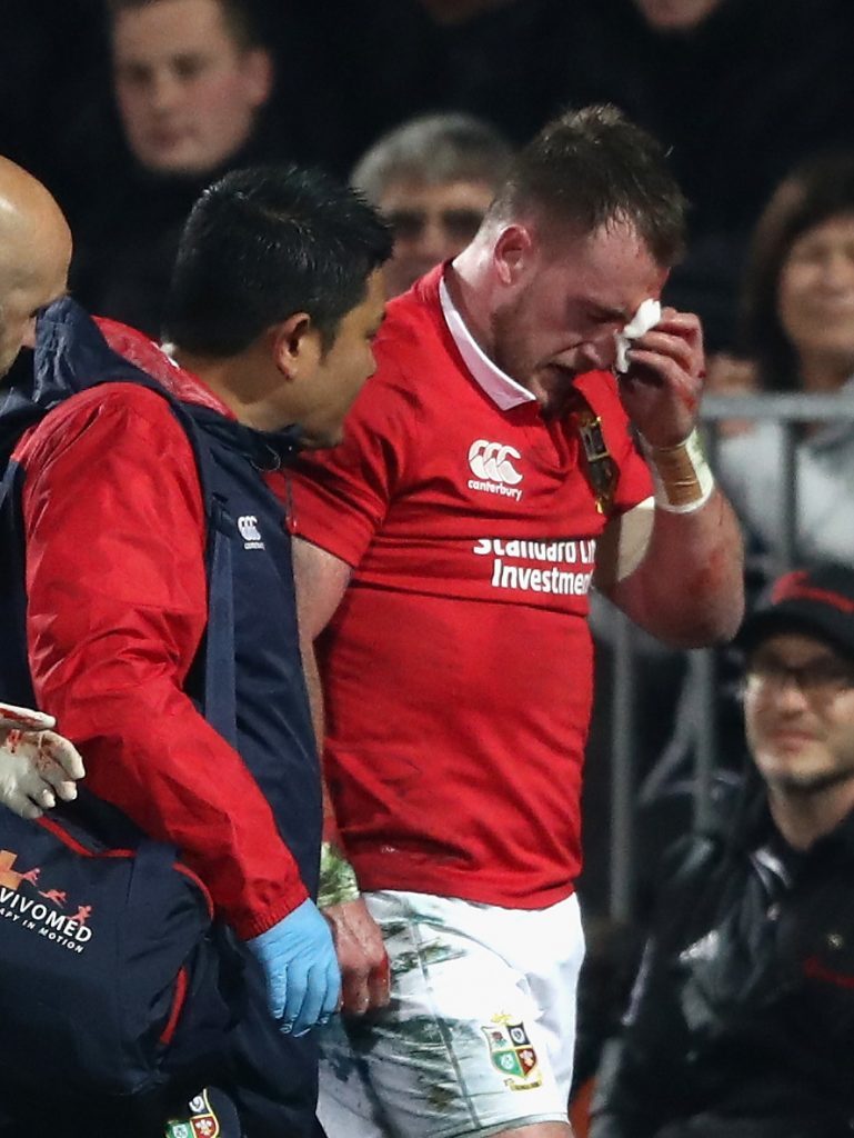 CHRISTCHURCH, NEW ZEALAND - JUNE 10: Stuart Hogg of the Lions is helped off after an eye injury during the match between the Crusaders and the British & Irish Lions at AMI Stadium on June 10, 2017 in Christchurch, New Zealand. (Photo by David Rogers/Getty Images)