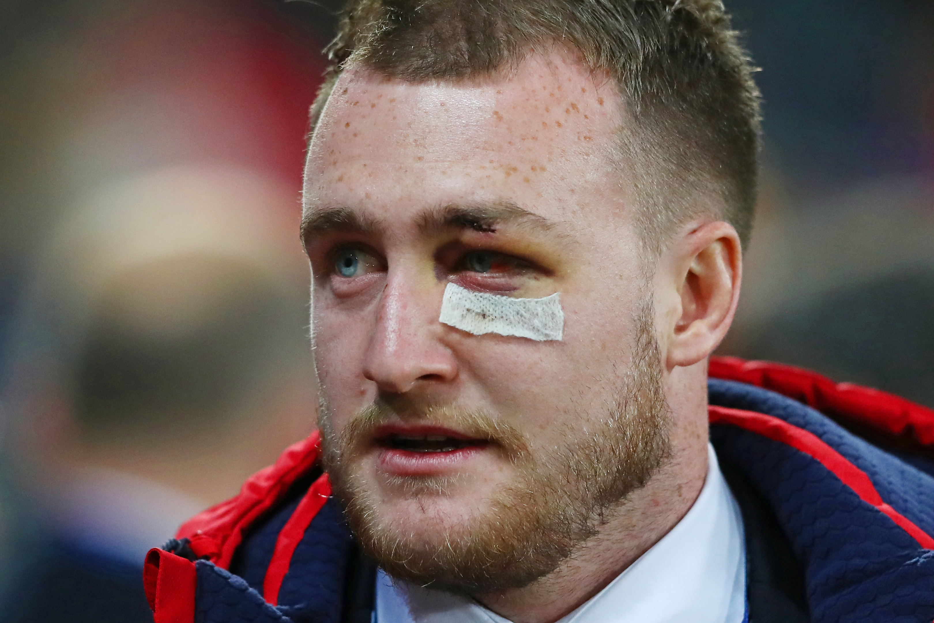 DUNEDIN, NEW ZEALAND - JUNE 13:  The injured Stuart Hogg of the Lions looks on prior to kickoff during the 2017 British & Irish Lions tour match between the Highlanders and the British & Irish Lions at the Forsyth Barr Stadium on June 13, 2017 in Dunedin, New Zealand.  (Photo by David Rogers/Getty Images)