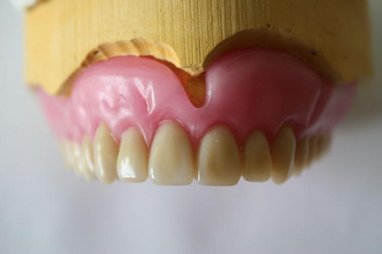 False teeth are among the items to be left behind by rail commuters.