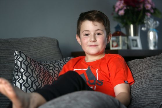 Finlay Reid was attacked by a Rottweiler on Fintry Drive last week