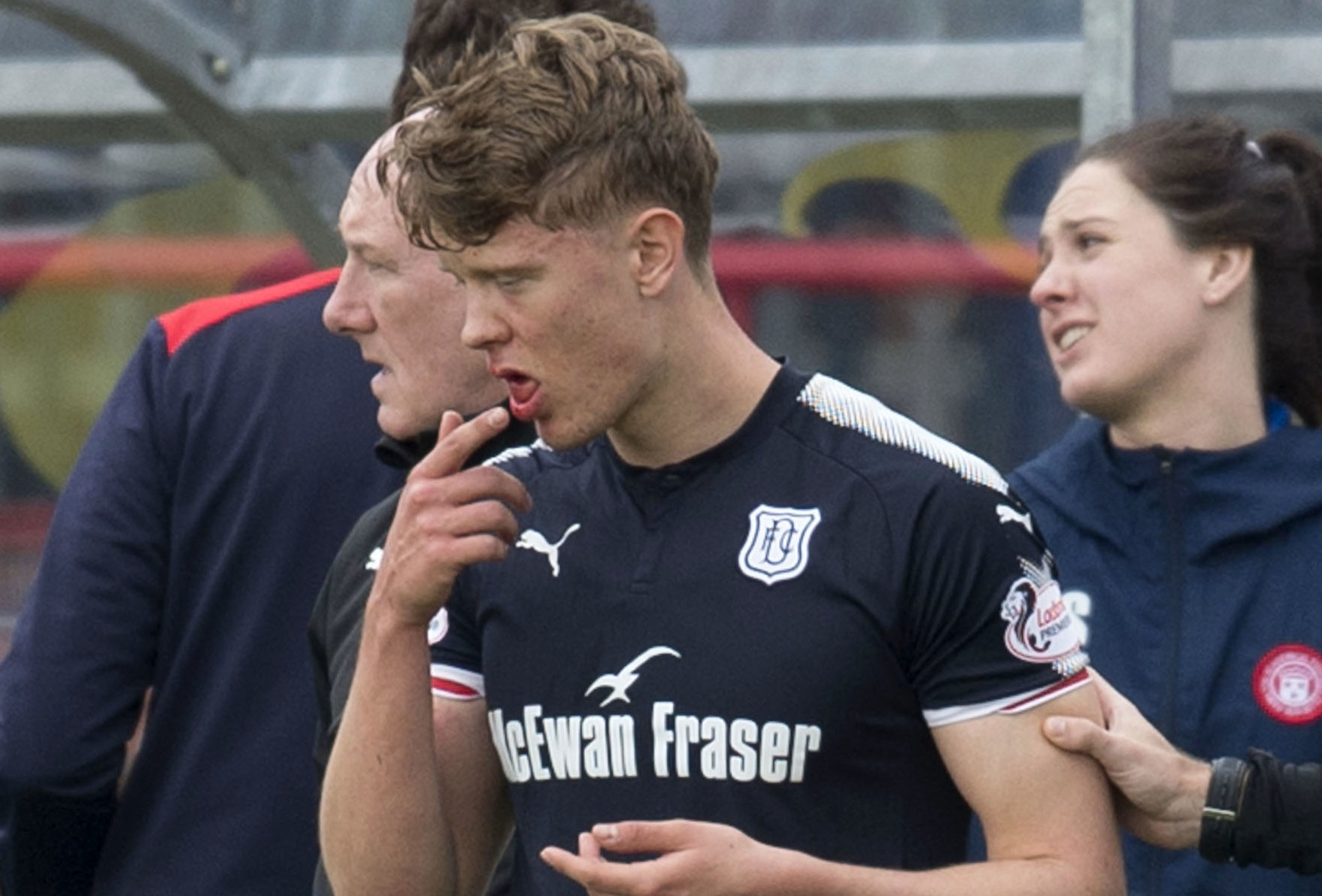 Dundee's Mark O'Hara after losing his two front teeth.