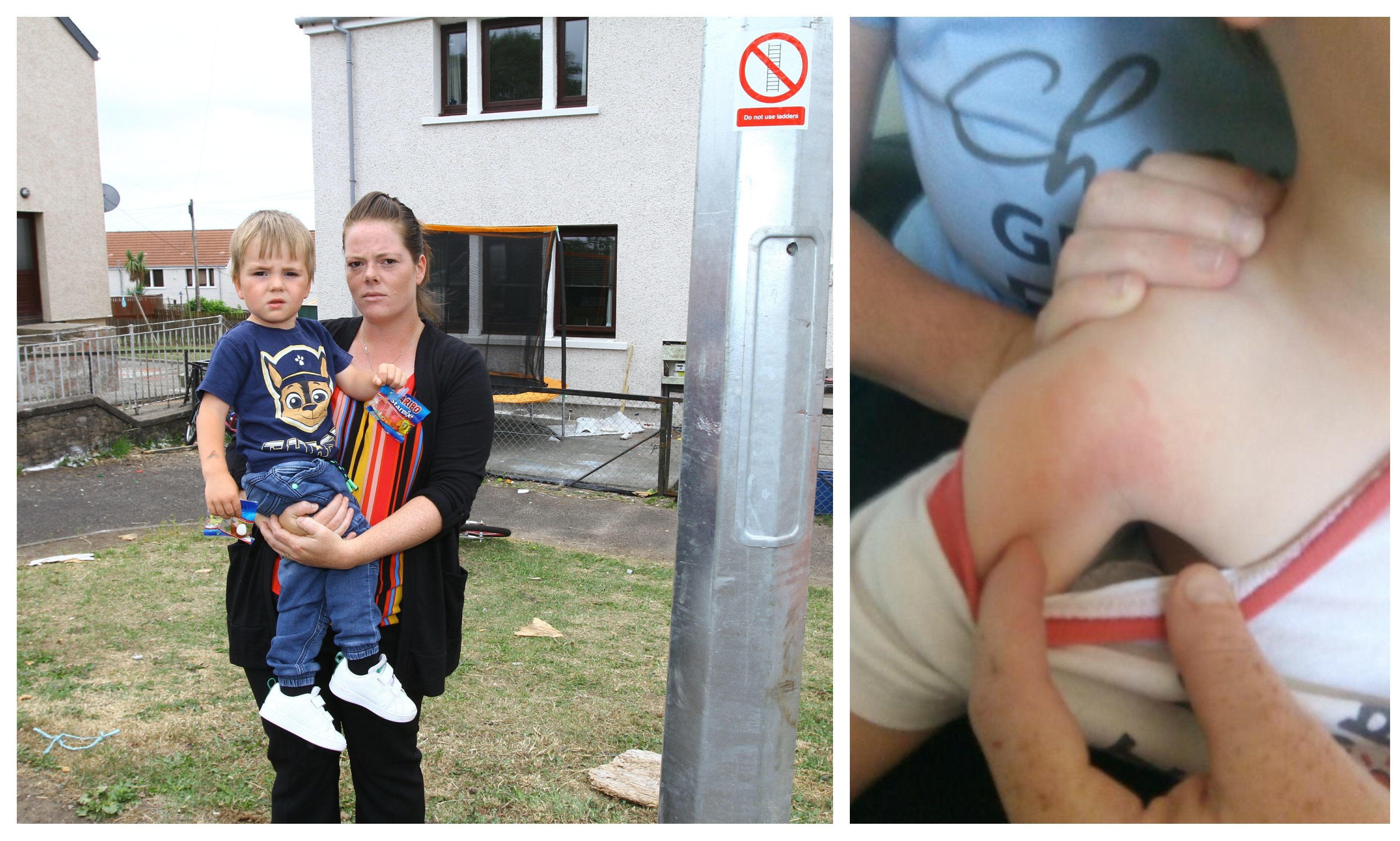 Sarah Watt and son, Adam. Right: Adam's injuries shown 10 days after the incident.
