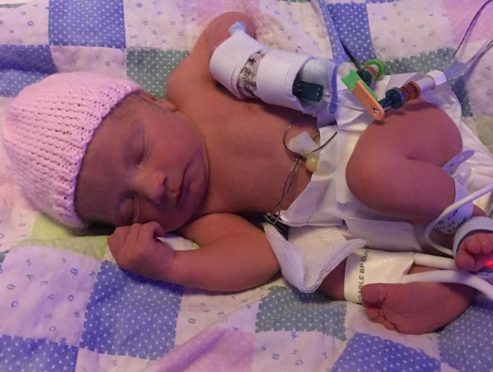 Little Emilie is now doing well — thanks to her quick thinking dad.