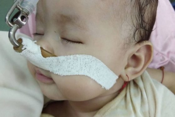 Baby Lena is awaiting surgery in Vietnam