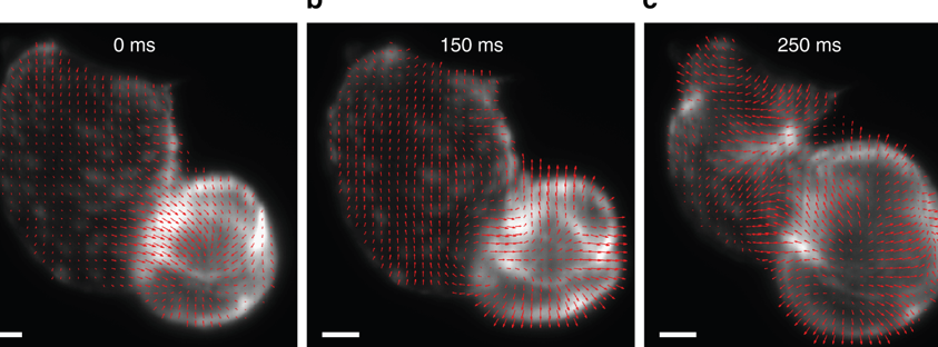 Light sheet microscopy with acoustic sample confinement