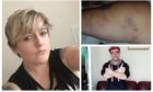 Becky Young, left, and some of her injuries. Bottom right: Alexander Smith.
