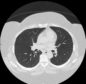 A chest CT scan is just one of the images that will be used in the new research tool.