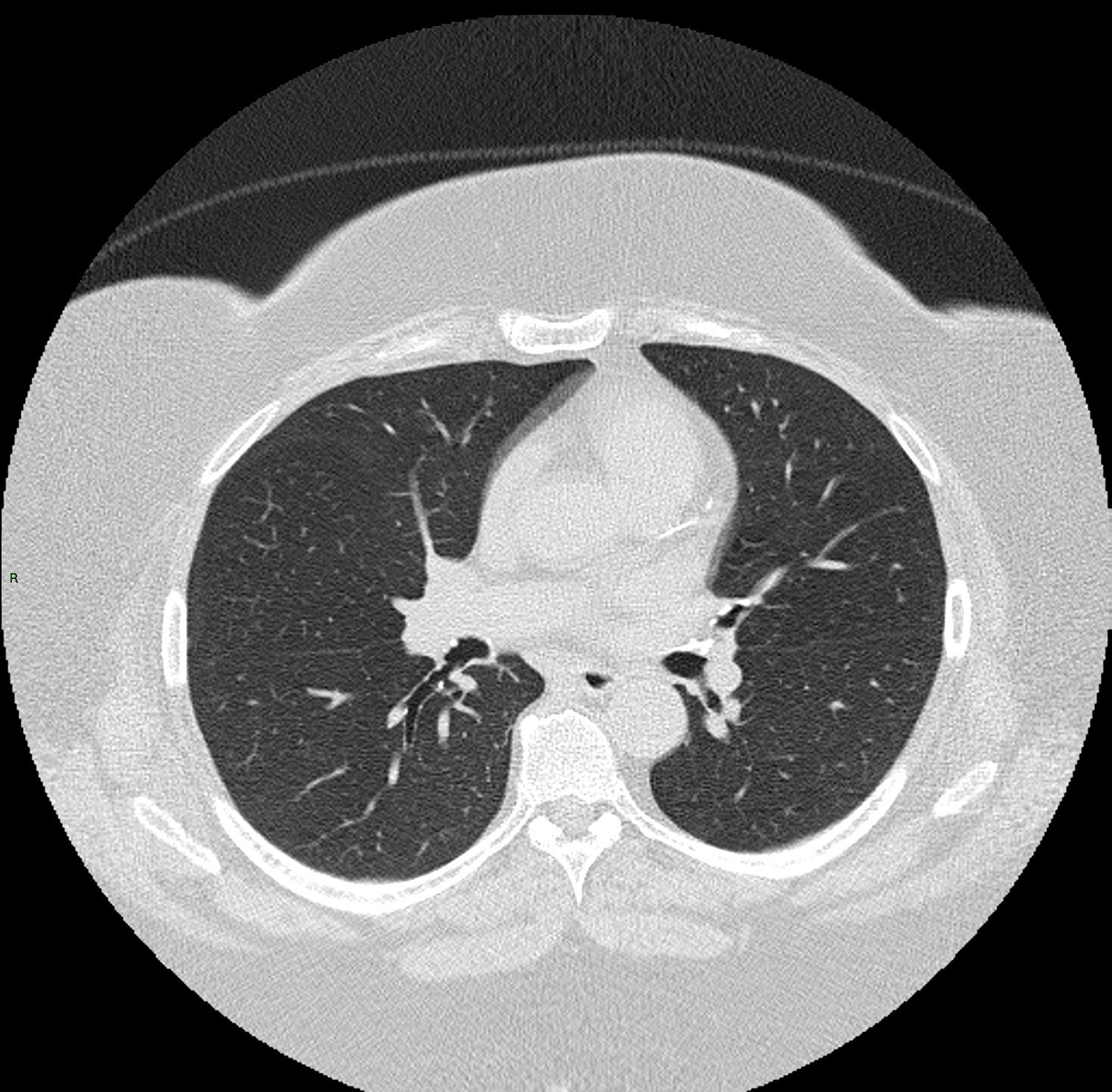 A chest CT scan is just one of the images that will be used in the new research tool.