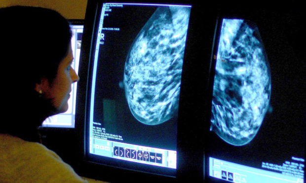 A consultant analysing a mammogram.