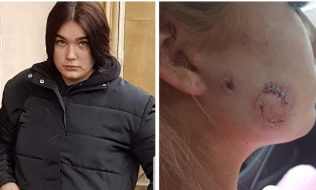 Left: Danielle Gaffar. Right: Kyra Strachan’s injuries.