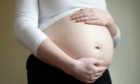 Teenage pregnancy rates are at their lowest level since reporting began - but Fife remains top of the pile.
