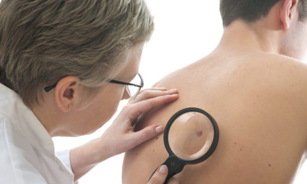 Dermatologist examines a mole of male patient