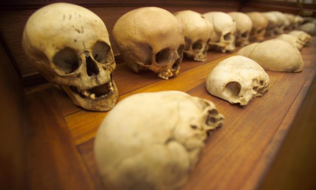 Skulls in the Old Edinburgh University Anatomy Museum circa 2004