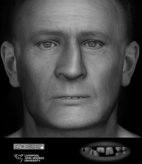 Ean Coutts facial reconstruction