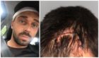 The 29-year-old was taken to Ninewells Hospital where he received 15 stitches to close a huge gash on his hairline.
