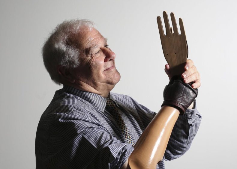 The late Eddie Small, disability campaigner and tutor at Dundee University, with a prototype hand at Hands of X. Supplied by Michael McGurk.