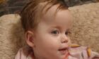 Forfar toddler Kinsley is set for a high-risk surgery
