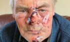 Sandy Brown, 63, was attacked by a dog in Meigle's Victory Park.