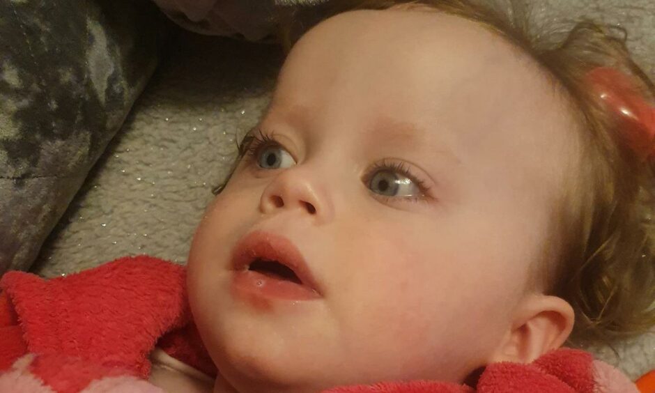 Forfar toddler Kinsley almost died during surgery last year