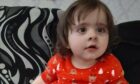 Two-year-old Cassie has Rett syndrome.