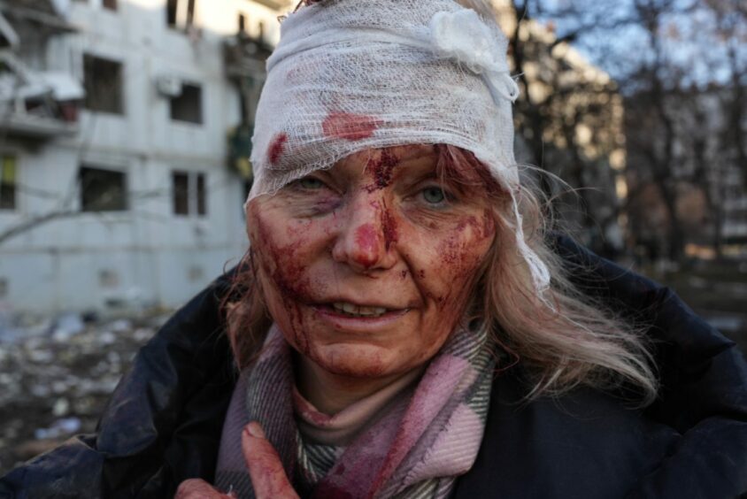 A wounded woman is seen as airstrike damages an apartment complex outside of Kharkiv, Ukraine on February 24