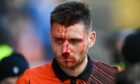 Ryan Edwards was forced off with a suspected broken nose