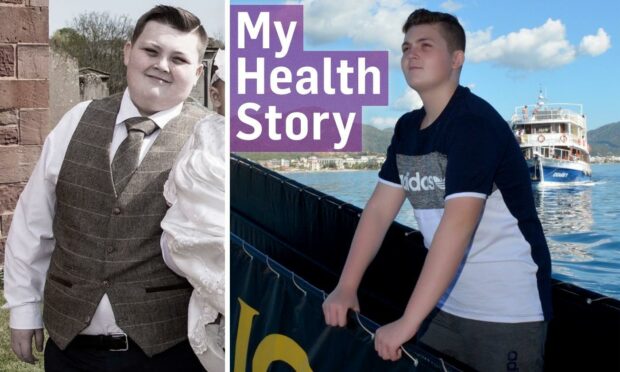 Angus teen Kenzie before and after his weight loss transformation