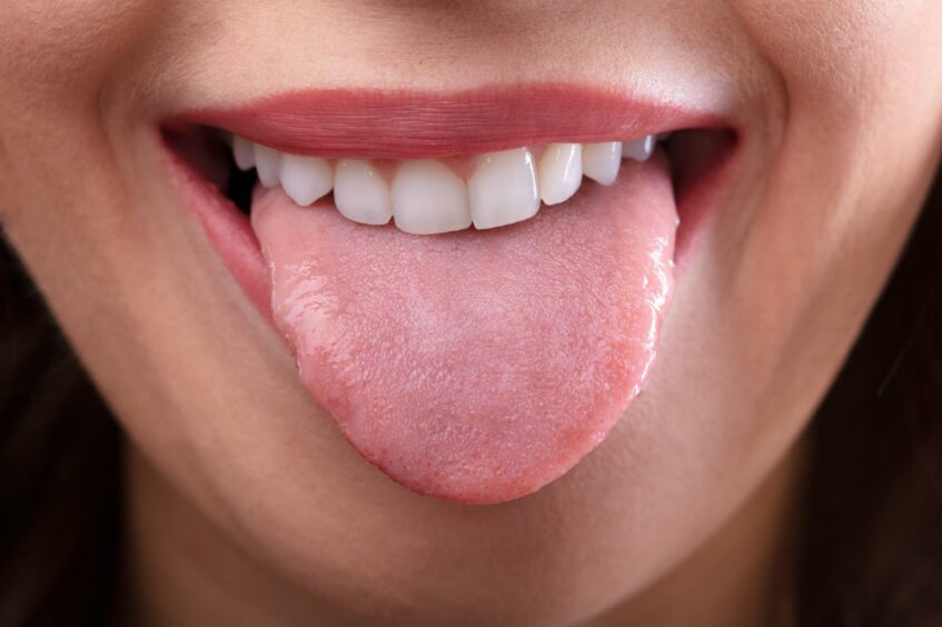 Burning tongue is an unusual symptom.