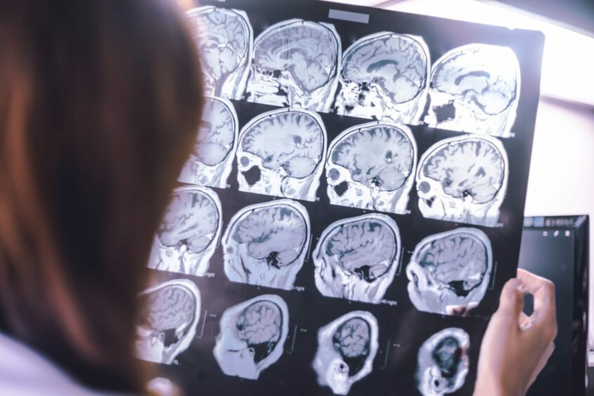 A woman looking at results from a MRI scan of a brain