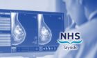 NHS Tayside breast cancer services
