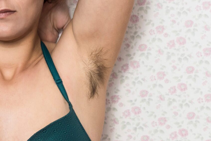 Photo shows a woman showing a hairy armpit.